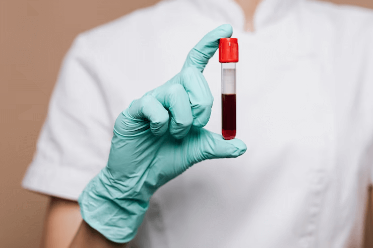 What Can You Do with a Blood Sampling Course? Exploring Job Demand in London  