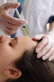 Hair restoration Alexandria