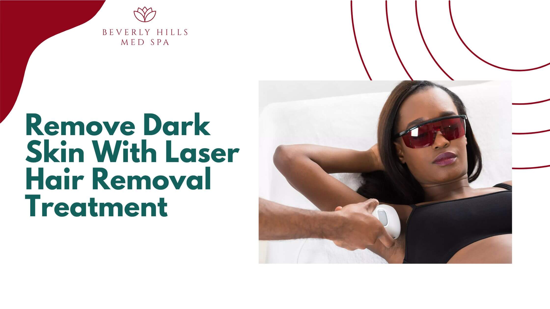 Remove Dark Skin With Laser Hair Removal Treatment?