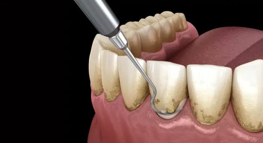 The Smile Clinic Jolimont: Where Modern Dentistry Meets Compassionate Care