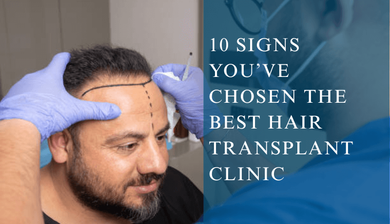 best hair transplant in LA