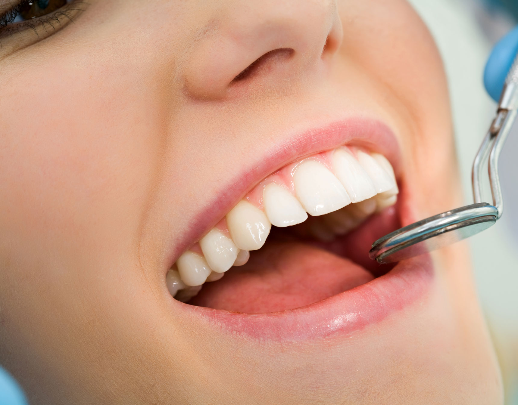 What Is the Average Cost of a Root Canal in Houston, TX?