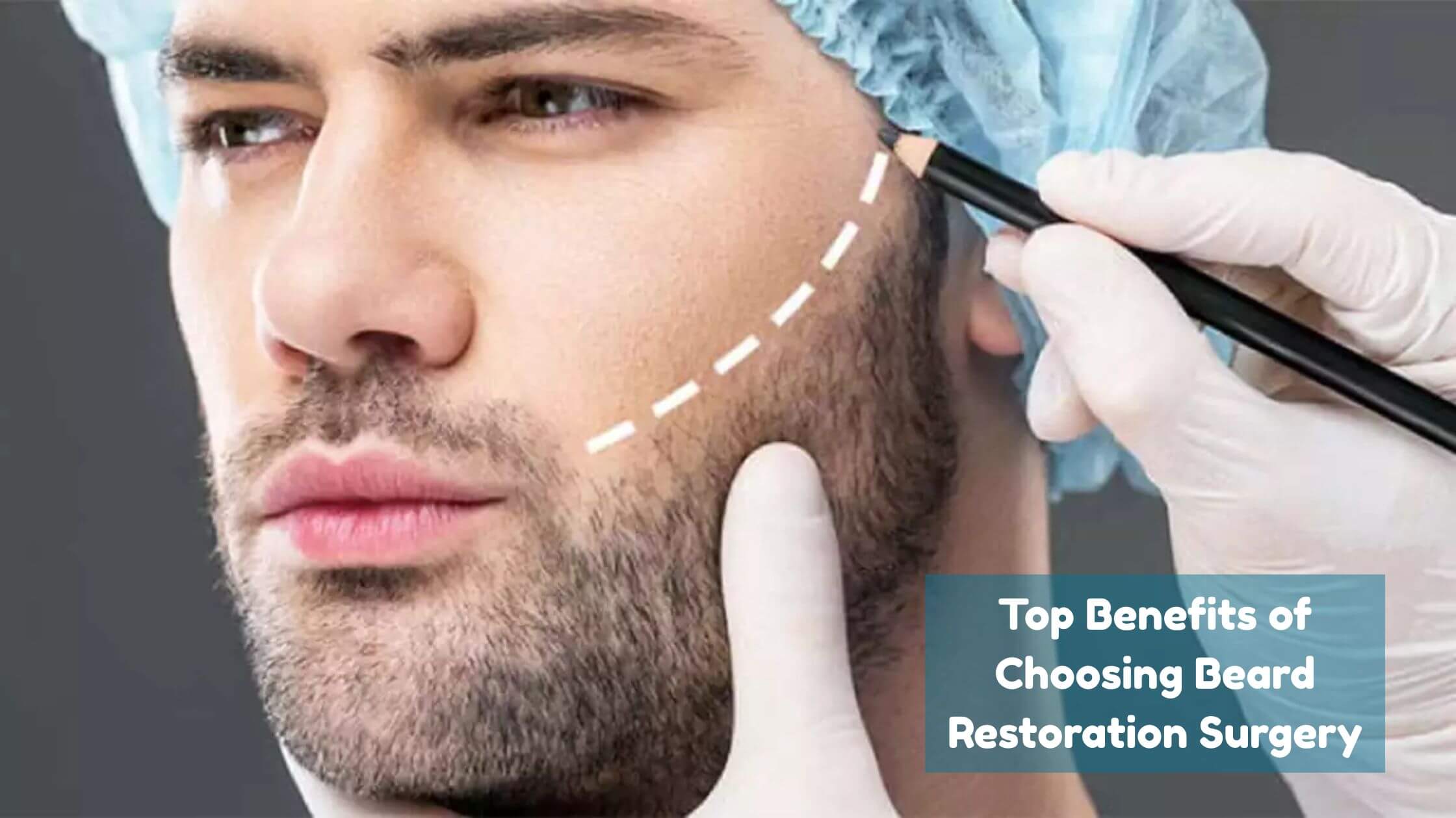 beard restoration