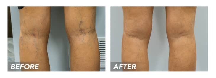 when to see a vascular doctor