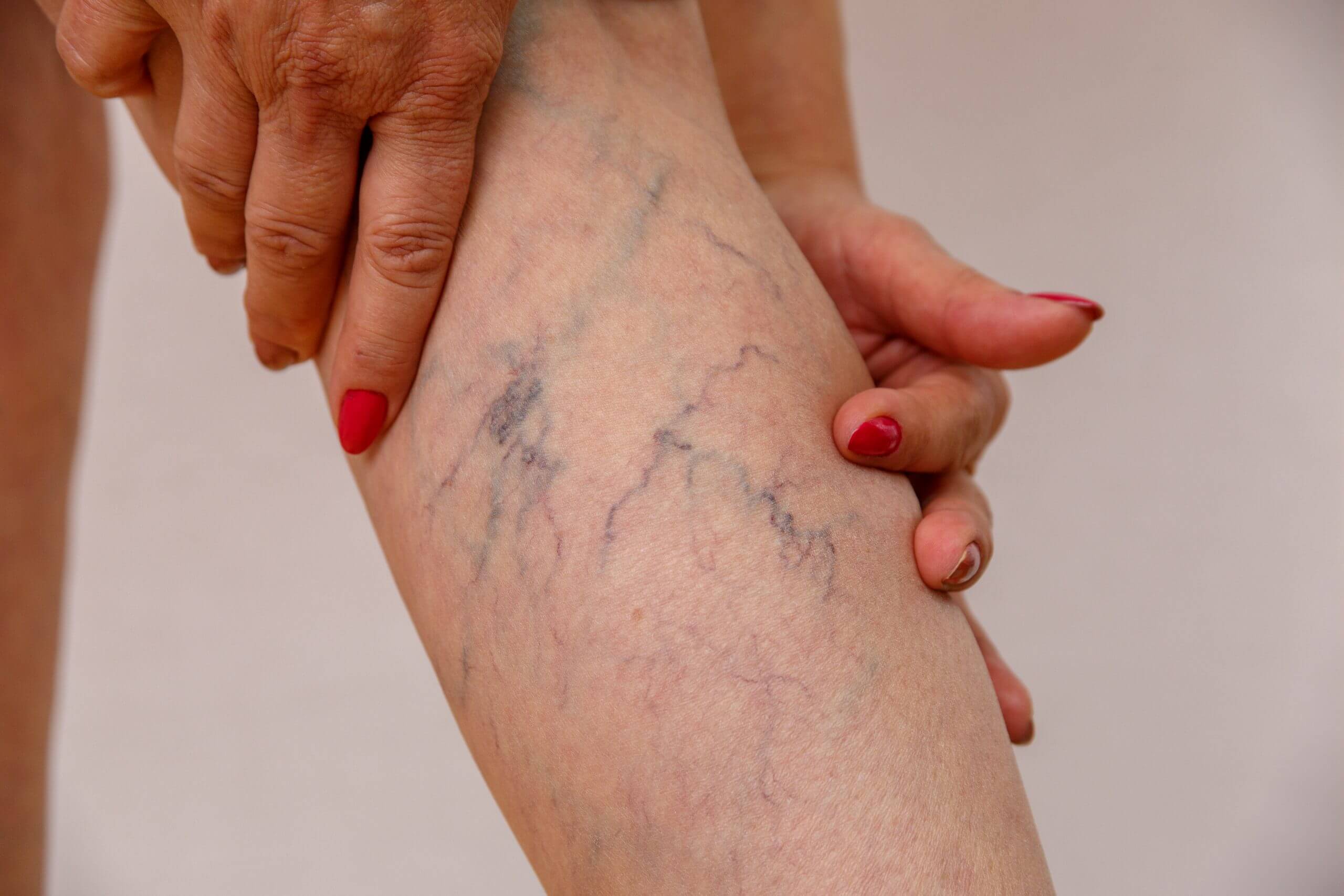 What is a vein doctor called, and what do they specialize in?