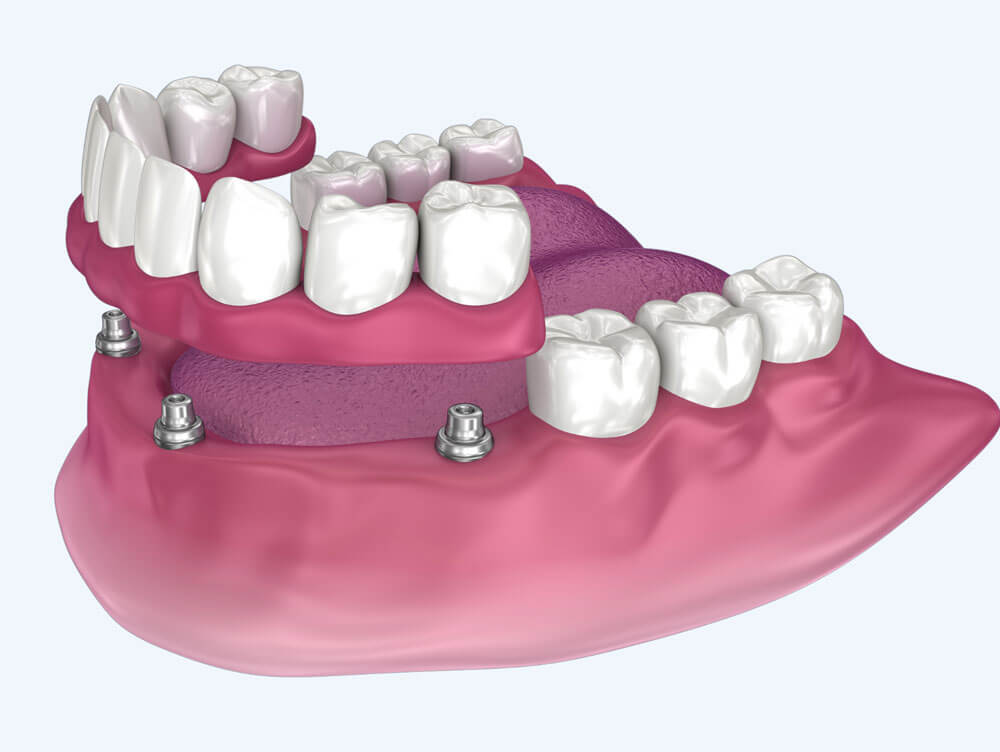 Is a Cosmetic Dentist Different from a General Dentist?
